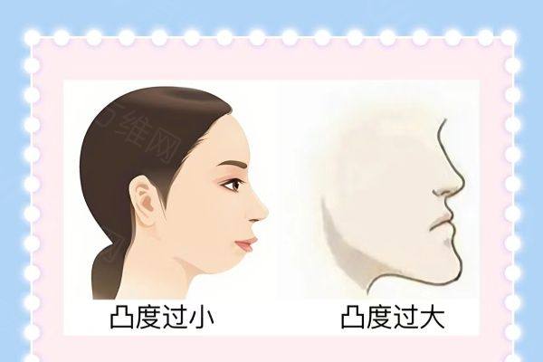 下巴后缩如何矫正？www.zgszw.com