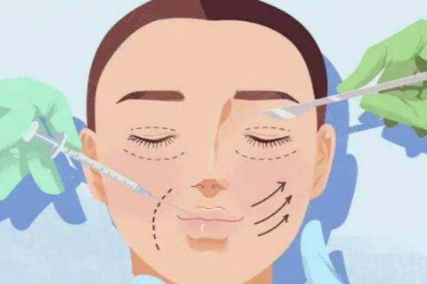 北京师丽丽双眼皮手术费用多少钱zgszw.com