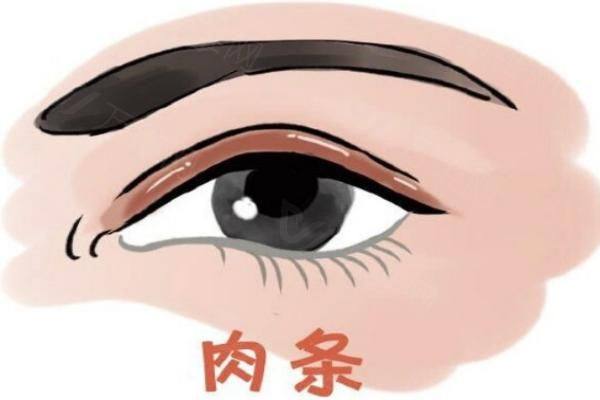 师丽丽修复双眼皮怎么样zgszw.com