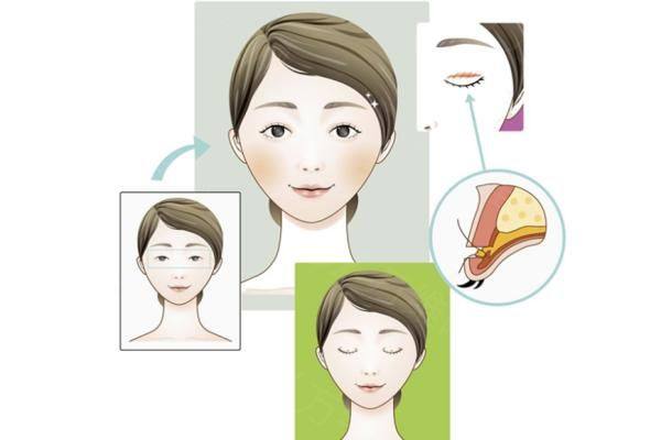 苏州孙军整形医生怎么样iyuxrv.cn