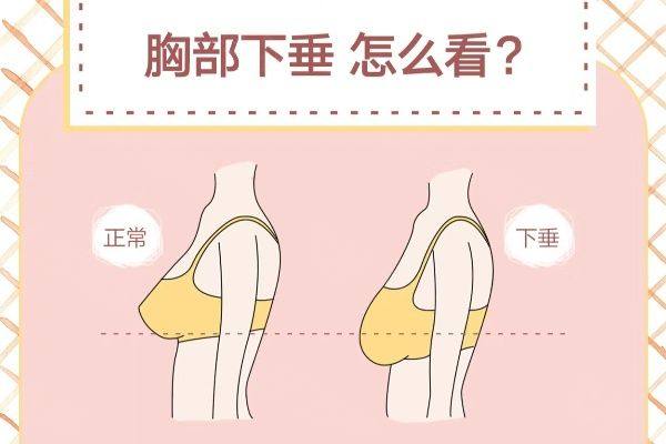 南京美贝尔黄名斗隆胸怎么样www.zgszw.com