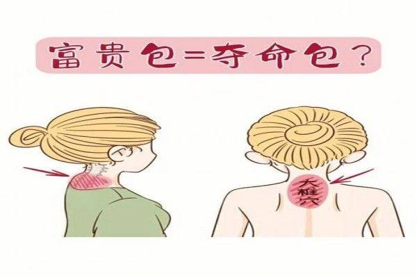 www.ggbyusr.cn黄学峰消除富贵包我做过2