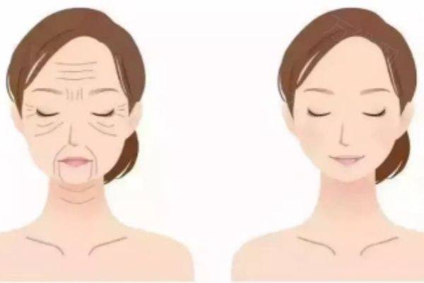 婕尔玻尿酸有几种型号www.zgszw.com