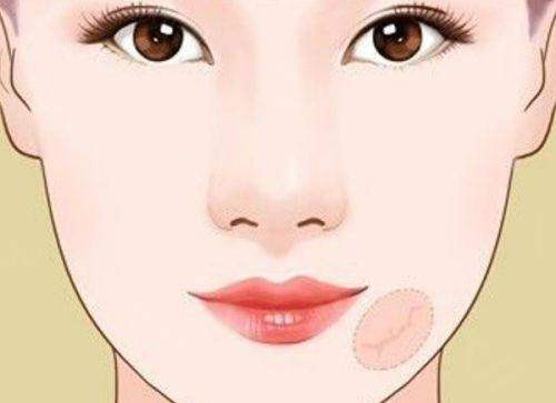 广州军美整形医院挂号难吗？不难！线上多渠道便捷挂号，满足你变美的急切需求 