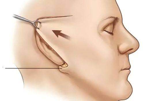 深圳宝丽医疗美容门诊部聂友才是啥级别？带你一探究竟他的专业高度！ 