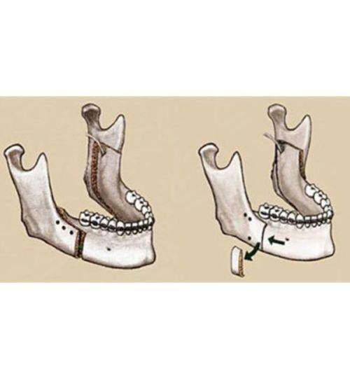 2025广州韩妃医疗美容医院收费价格表：眼部整形3000元起！ 