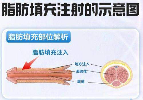 广州军美整形医院收费价目表2025公布！吸脂、眼鼻胸整形等项目价格实惠！ 