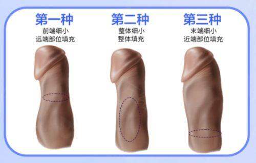 2025广州军美整形医院收费价格表公布！吸脂、眼鼻胸整形等项目价格实惠！ 