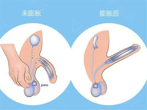 杭州薇琳医疗美容医院评价口碑怎么样？技术和服务双优太绝