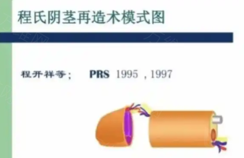 眼整形套餐