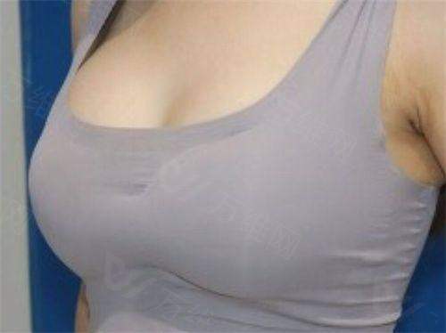 广州韩妃医疗美容医院邓晟华价格贵吗？不贵！价格合理且术后满意度高！ 