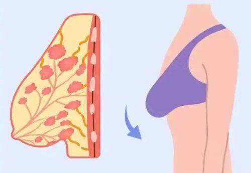 武汉艺星医疗美容医院杨国粱价格贵吗？不贵！2 - 10万起做假体隆胸，内窥镜技术创伤小恢复快！ 