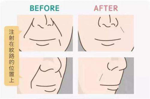 广州焕新颜医疗美容医院预约通道