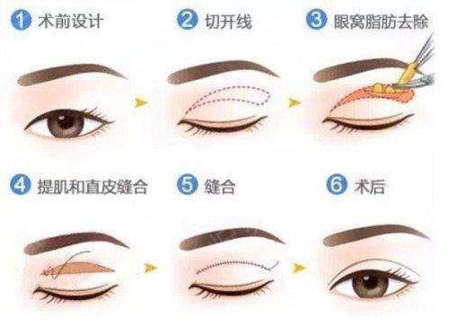 成都大麦植发医院可以用医保卡吗?通常不可,特殊情况部分省市能报!