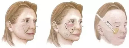 成都大麦植发医院在哪个地铁站下?总院5号线交子公园站等附详情!