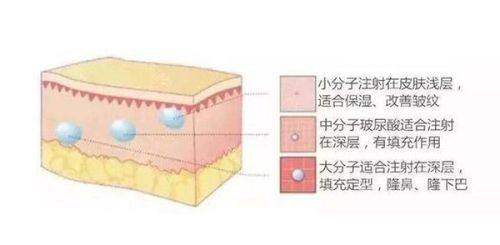 双眼皮套餐