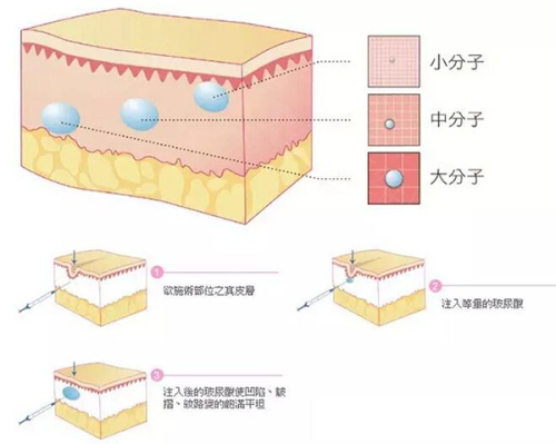 综合套餐