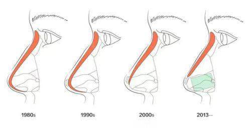 北京润颜医疗美容医院患者真实实例