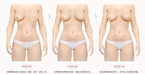 广州菲思医疗美容门诊部收费价格表揭秘:生长因子取出12800元起!