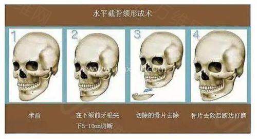 广州中家医家庭医生整形医院和北京中卫医疗美容诊所哪个好？前者优势更明显