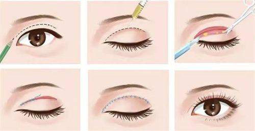 真实测评：西安国际医学中心整形医院师俊莉和孙峰哪个更靠谱？专家技术揭秘 