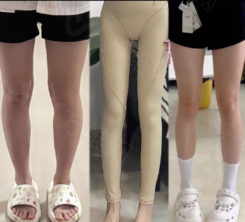 广州军美整形医院陈勇军口碑和患者评价如何？好评众多，顾客满意度高！ 