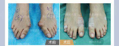 广州韩妃医疗美容医院邓晟华口碑和患者评价好吗？众多患者点赞，术后效果自然！ 