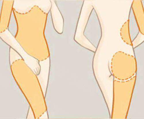 广州军美整形医院收费价目表2025揭秘：吸脂/眼鼻胸整形等项目价格实惠！ 