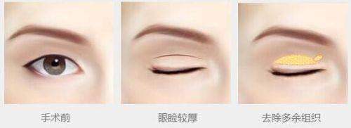 广州军美整形医院陈勇军价格贵吗？不贵！祛斑项目价格合理，成功案例多带来美丽蜕变！ 