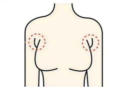 广州军美医疗美容医院价格表揭秘：眼部整形3000元起，价格超心动！ 