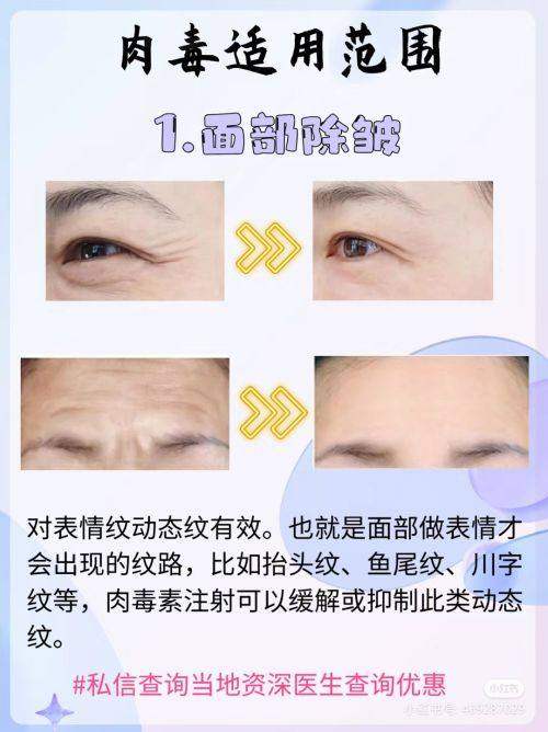 广州倍生植发医院坑不坑？不坑！其凭借专业技术与优质服务