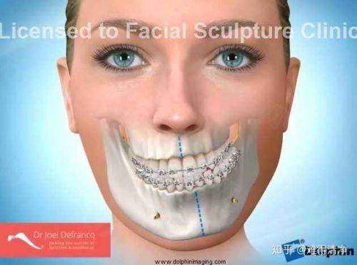 三、医院口碑怎么样?