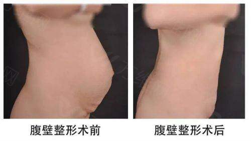 深圳美莱医疗美容医院怎么乘地铁去？搭乘地铁 3 号线到石厦站，从 A 出口出站即达，超方便！ 