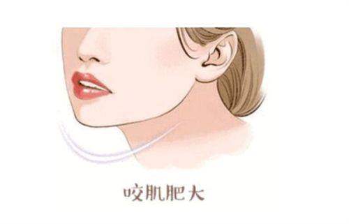 四、深圳阳光整形美容医院的价格情况