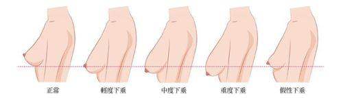 2025广东省医美医院价目表公布！双眼皮980元起，隆鼻2980元起！ 