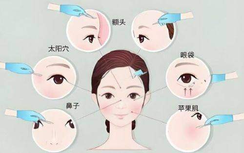 济南艺星整形医院公交怎么坐相关补充