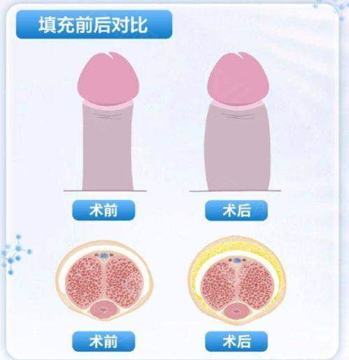 整形医院刷医疗保险卡相关知识