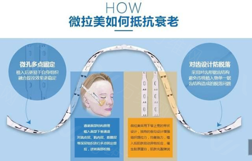 广州倍生植发医院收费标准揭秘：植发低至8800元起，养发套餐9800元起