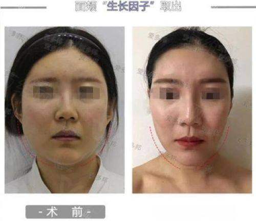 二、广州美莱医疗美容医院是不是莆田系?它有非凡的医生团队