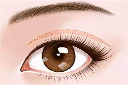 成都男士私密脱毛医院排名？成都曙光医院、成都军大医院等凭借专业技术与优质服务上榜！ 