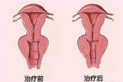 二、广州倍生植发医院收费标准怎么样？