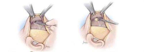 三、广州美莱医疗美容医院院长的服务理念优势