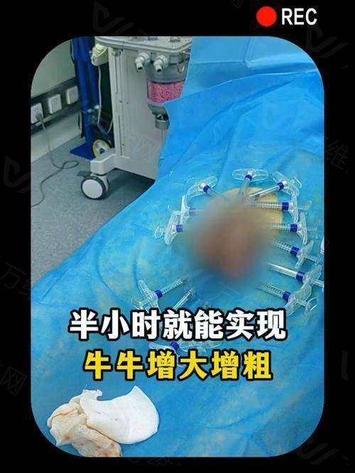 潍坊天宏医疗美容医院在潍坊市做男性增粗很有名吗？没错！它凭借多年经验和专业技术
