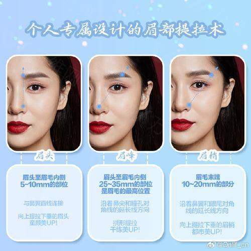 大连市眉部整形口碑好吗？专家团队定制眉形+本地顾客好评率96%