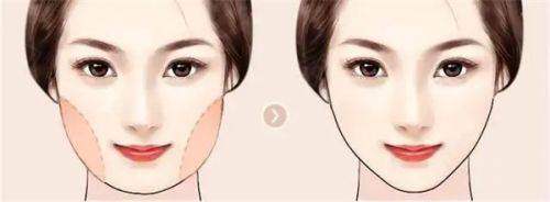 杭州阿波罗医院靠谱吗？靠谱！2025年众多患者亲测，专业服务与先进技术超给力