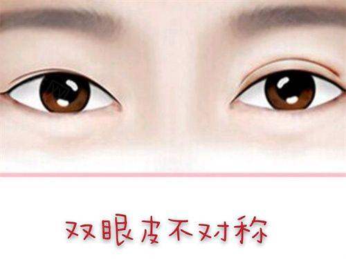 综合套餐