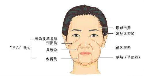 二、深圳杨建荣拉皮医生手术费在不同年龄段人群中有何差异？