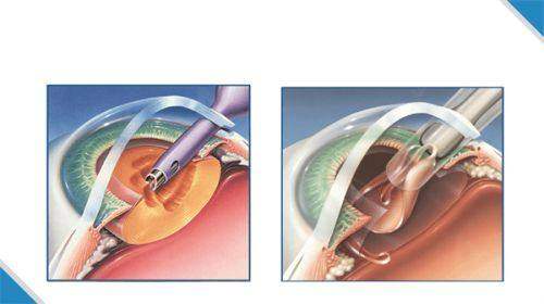 重庆东上整形医院怎么样？正规靠谱技术优，疤痕修复案例效果惊艳！ 