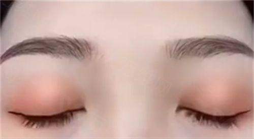 福建疤痕修复哪个医院好？福州玛恩、省立、协和等医院排名前三，快来了解！ 