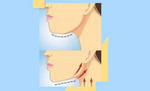 重庆东上整形医院怎么样？正规靠谱，疤痕修复效果惊艳，值得信赖！ 